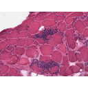 640px-Polymyositis_HE.jpg<>Živalske celice pod mikroskopom